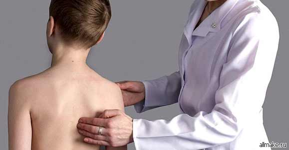 Нарушение осанки (профилактика, причины, лечение)